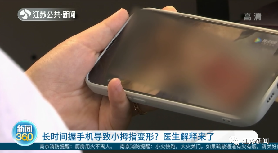 你会用小拇指托住手机吗？收下这则医生提醒！