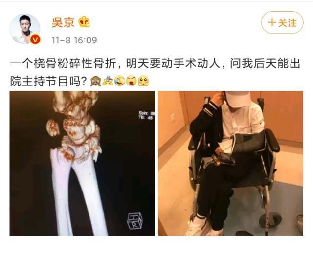 谢楠桡骨粉碎性骨折需动手术 网友：愿早日康复