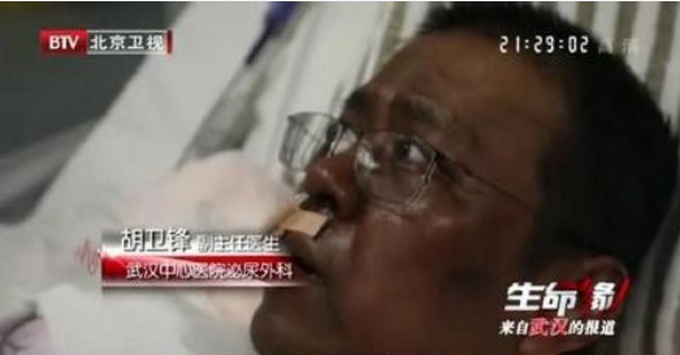 武汉中心医院医生胡卫锋离世，抢救一个多月，但脑出血情况严重